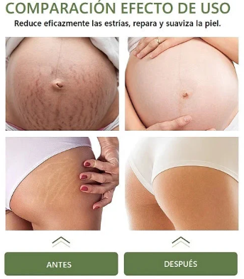 CREMA ANTIESTRÍAS SKINREPAIR - COMPRA 1 Y OBTÉN 2